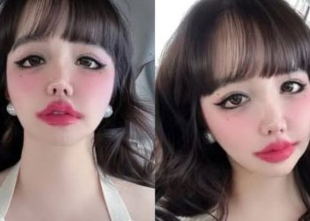 D-NATION Entertainment đưa ra thông tin cập nhật chi tiết về sức khỏe cảm xúc của Park Bom và kêu gọi tôn trọng quyền riêng tư của cô ấy